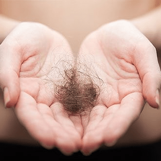 прочие причины выпадения волос